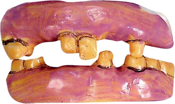 Photo du produit Dentier vieilles dents