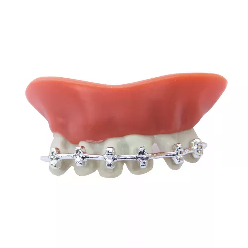DENTIER AVEC APPAREIL DENTAIRE (nécessaire de fixation inclus)